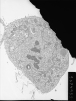 Prometaphase, group 4