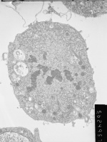 Prometaphase, group 4