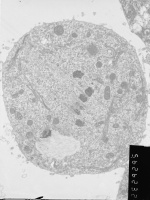 Prometaphase, group 4