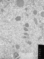 Prometaphase, group 4