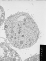 Prometaphase, group 4