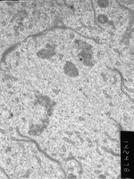 Prometaphase, group 4