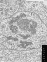 Prometaphase, group 3