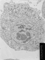 Prometaphase, group 3