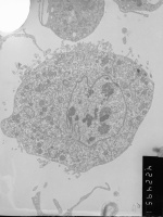 Prometaphase, group 3