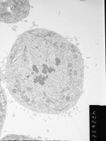 Prometaphase, group 4