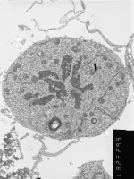 25. Metaphase transverse