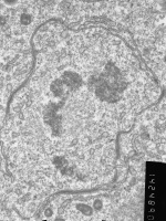 Prometaphase, group 3