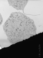 Prometaphase, group 4
