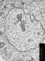 Prometaphase, group 3