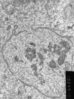 Prometaphase, group 2