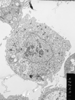 Prometaphase, group 2