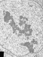 Prometaphase, group 1