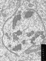 Prometaphase, group 2