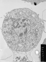 Prometaphase, group 2