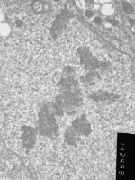 Prometaphase, group 3