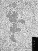 30. Metaphase