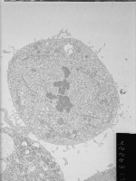 31. Metaphase