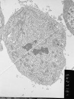 Prometaphase, group 4