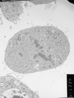 Prometaphase, group 4