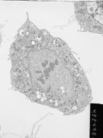 Prometaphase, group 4