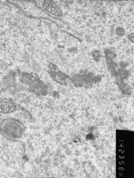 Prometaphase, group 4