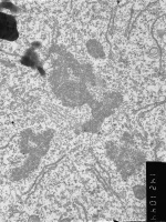 Prometaphase, group 4