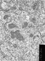 Prometaphase, group 4