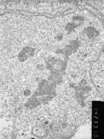 Prometaphase, group 4