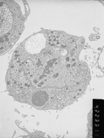 Prometaphase, group 4