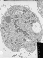 Prometaphase, group 4