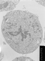 Prometaphase, group 4