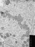 Prometaphase, group 4