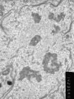 Prometaphase, group 4