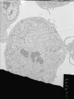 53. Metaphase