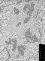 Prometaphase, group 4