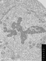 Prometaphase, group 4