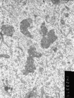 Prometaphase, group 4