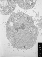 61. Metaphase