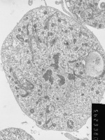 Prometaphase, group 4