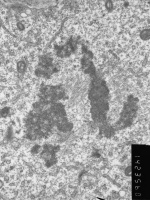 Prometaphase, group 4