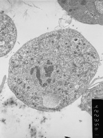 Prometaphase, group 4