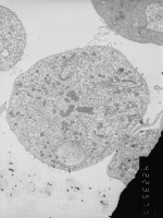 Prometaphase, group 4