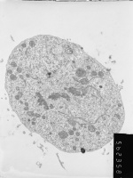 Prometaphase, group 4