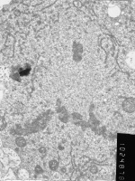 Prometaphase, group 4