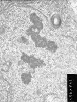 Prometaphase, group 4