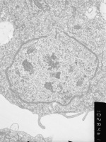 Prometaphase, group 2