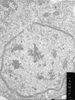 Prometaphase, group 2