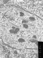 Prometaphase, group 2