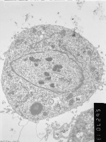 Prometaphase, group 2